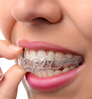 Clear Aligners - Almost Invisible Braces Long Branch, NJ