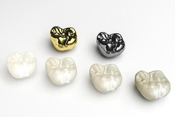 My New Dental Crown: Zirconia Vs  Gold