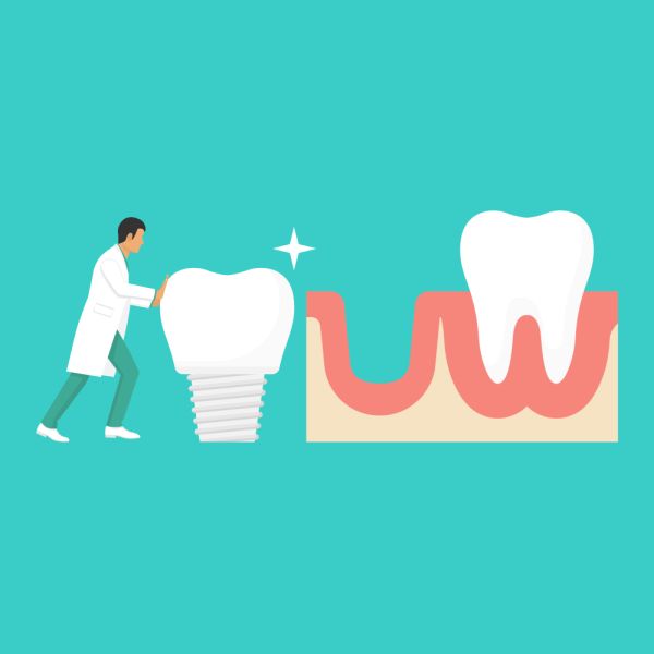 Dental Implants Professional Long Branch, NJ