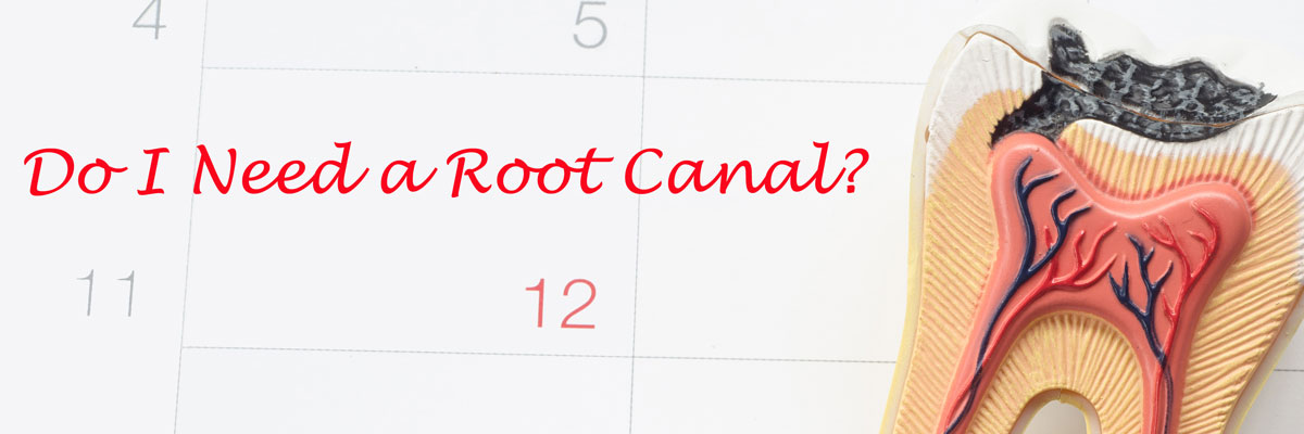 Long Branch Do I Need a Root Canal