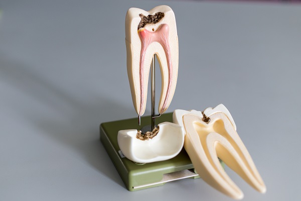 What Are The Most Common Endodontic Procedures?
