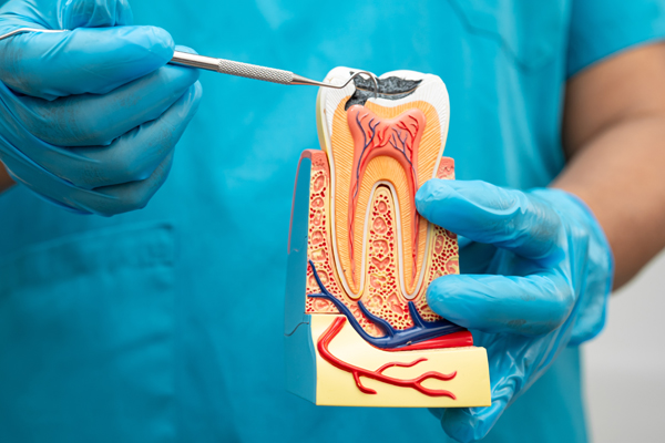 Endodontics Explained: FAQs