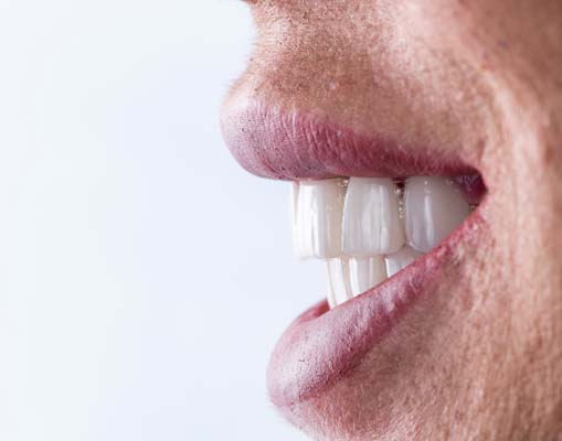 Implant Supported Dentures Long Branch, NJ