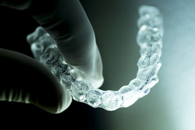 What You Should Know About Invisalign® Vs Braces