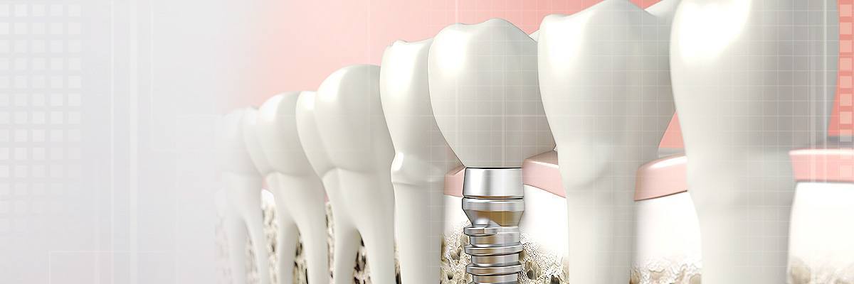 Long Branch Periodontics