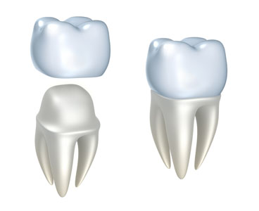 Visit A Long Branch Restorative Dentist If You Are Missing Teeth