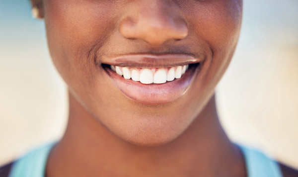 Smile Makeover Options Before The Big Day
