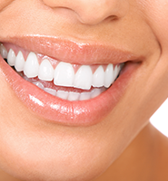 Teeth Whitening Services Long Branch, NJ