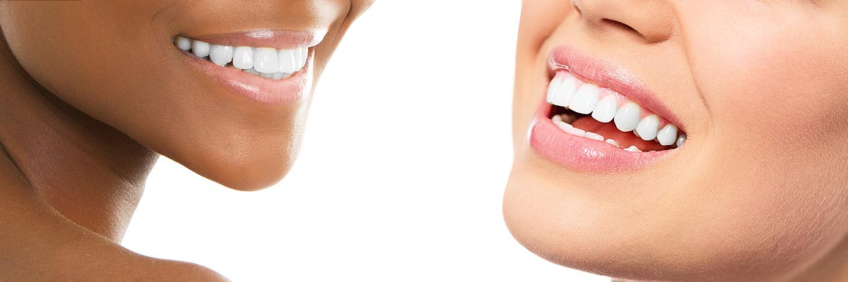 Long Branch Teeth Whitening