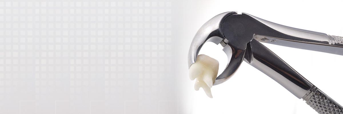 Long Branch Tooth Extraction